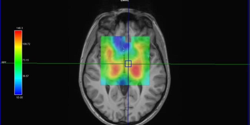 combined MRI of Brain