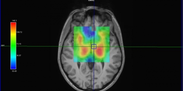 combined MRI of Brain