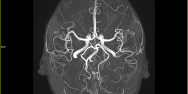 MRI of human brain vasculature