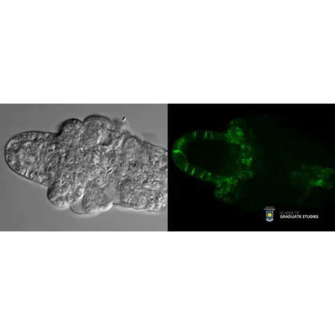 "Bright" Beginnings: The Path from Ovule to Seed